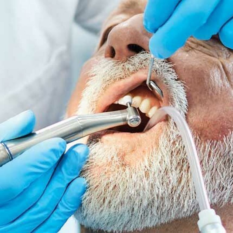 Dental Hygiene and Alzheimer's Disease